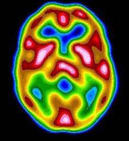 A Brain Scan