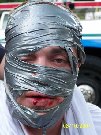 This man's head exploded, and had to be put back together with duct tape.